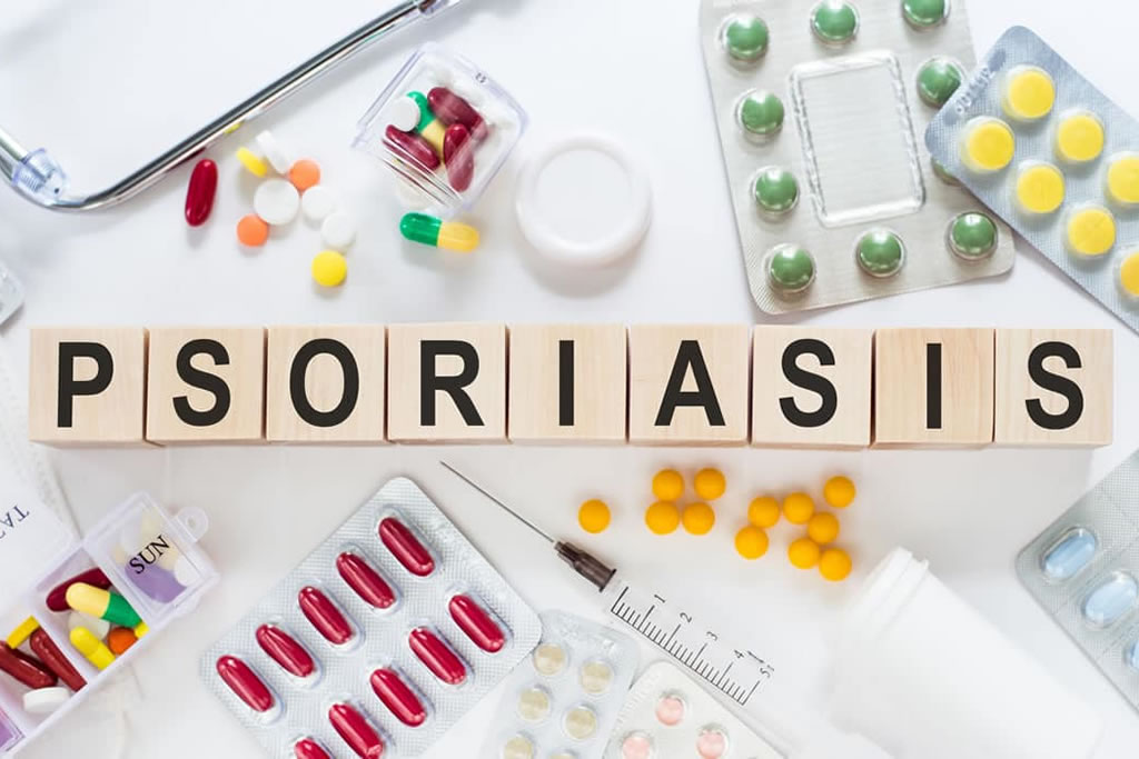 Lijekovi za psorijazu