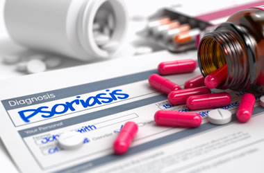 Psorijaza